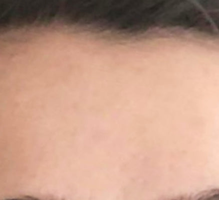 AFTER 12 WEEKS
